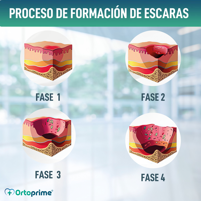 Cojín Antiescaras Viscoelástico para Coxis 60kg/m3
