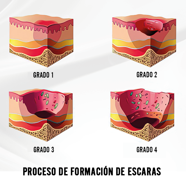 Cojín Antiescaras Cuadrado Látex Anatómico