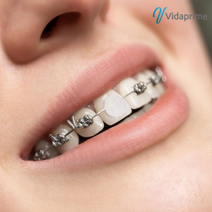 cera-dental-transparente-para-brackets-vidaprime-ortoprime