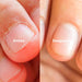 unas-mordidas-esmalte-ortoprime